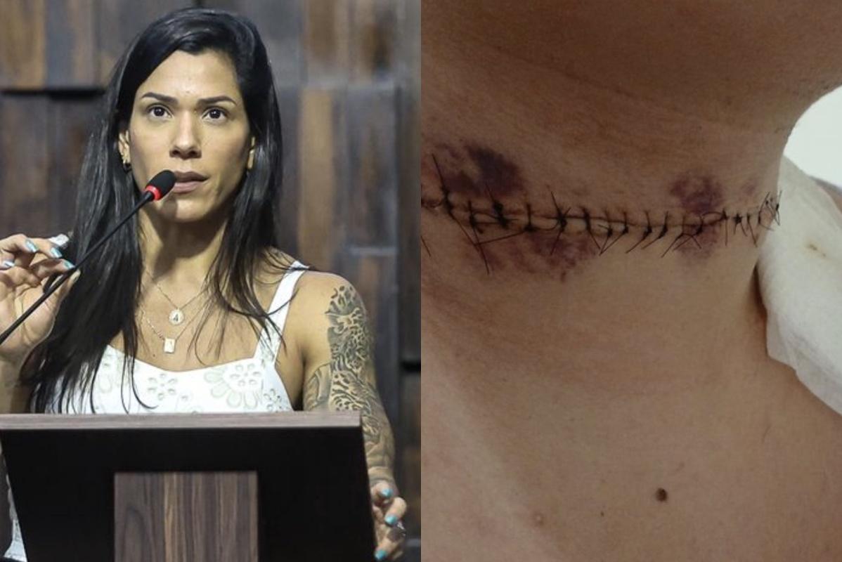 Índia Armelau propõe na Alerj multas de até R$ 99 mil por uso de linhas cortantes e interdição de quem vende