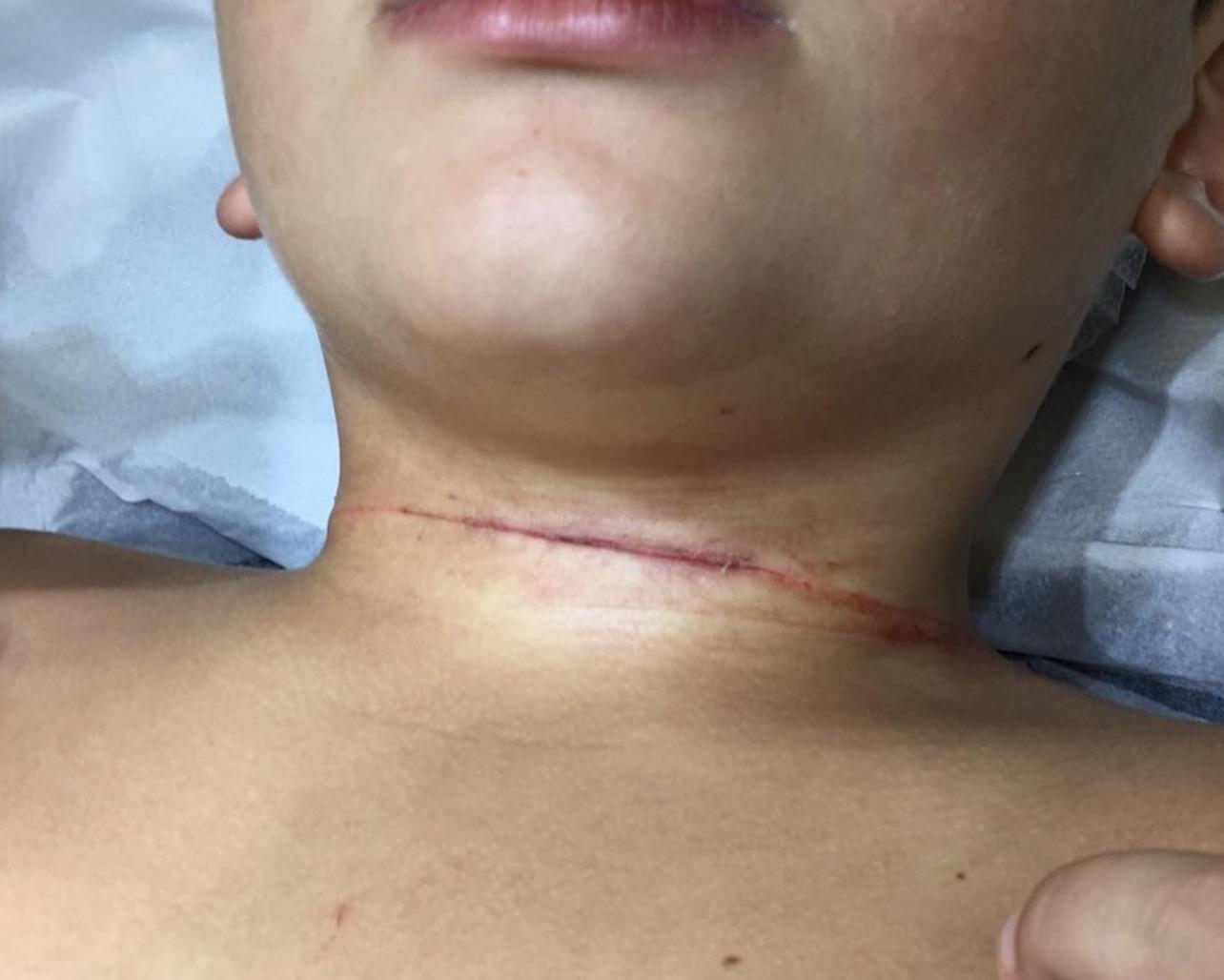 ALERJ contra Linha Chilena no RJ