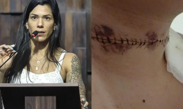 Índia Armelau propõe na Alerj multas de até R$ 99 mil por uso de linhas cortantes e interdição de quem vende